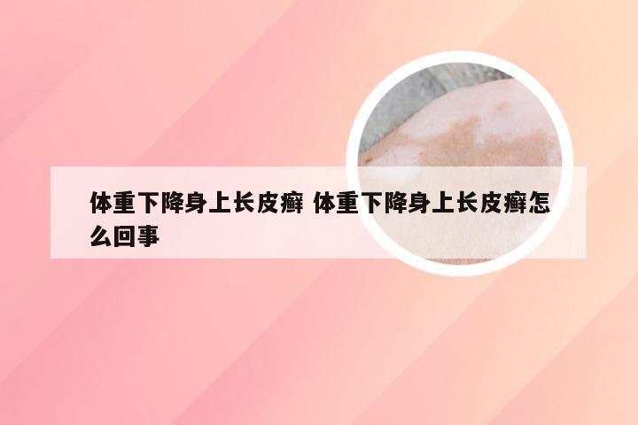体重下降身上长皮癣 体重下降身上长皮癣怎么回事