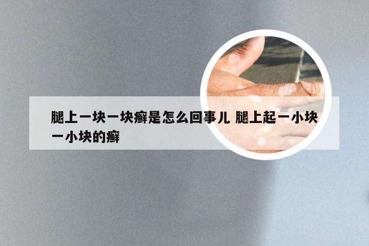 腿上一块一块癣是怎么回事儿 腿上起一小块一小块的癣