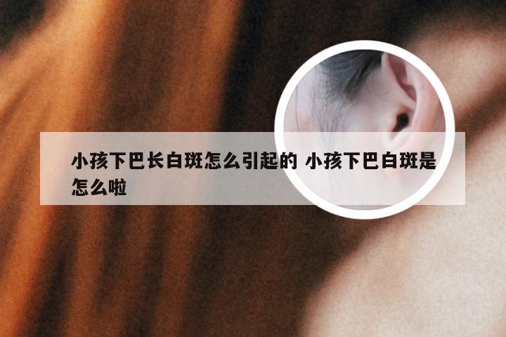 小孩下巴长白斑怎么引起的 小孩下巴白斑是怎么啦