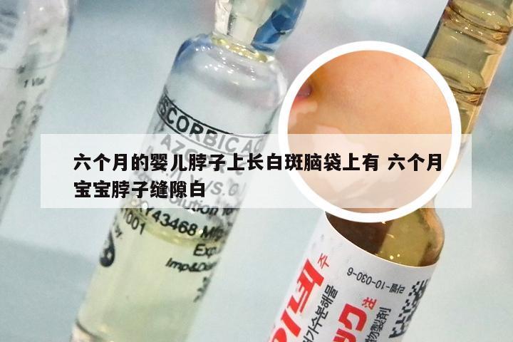 六个月的婴儿脖子上长白斑脑袋上有 六个月宝宝脖子缝隙白