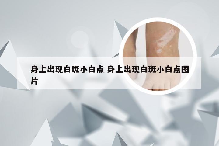 身上出现白斑小白点 身上出现白斑小白点图片