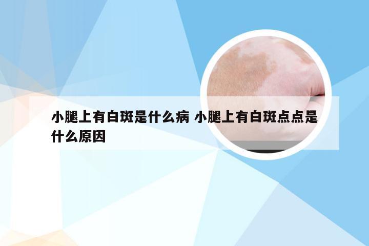 小腿上有白斑是什么病 小腿上有白斑点点是什么原因