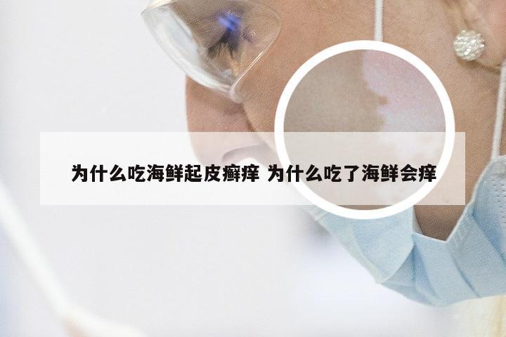 为什么吃海鲜起皮癣痒 为什么吃了海鲜会痒
