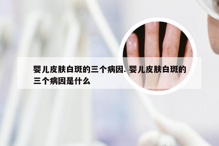 婴儿皮肤白斑的三个病因. 婴儿皮肤白斑的三个病因是什么