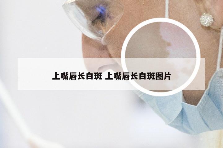 上嘴唇长白斑 上嘴唇长白斑图片