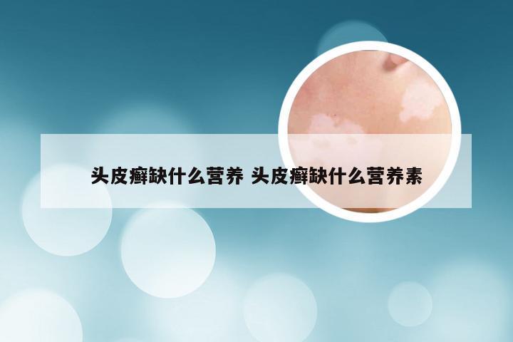 头皮癣缺什么营养 头皮癣缺什么营养素
