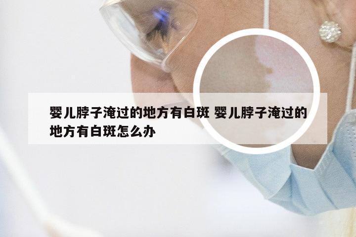 婴儿脖子淹过的地方有白斑 婴儿脖子淹过的地方有白斑怎么办