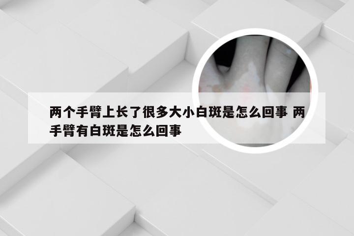 两个手臂上长了很多大小白斑是怎么回事 两手臂有白斑是怎么回事