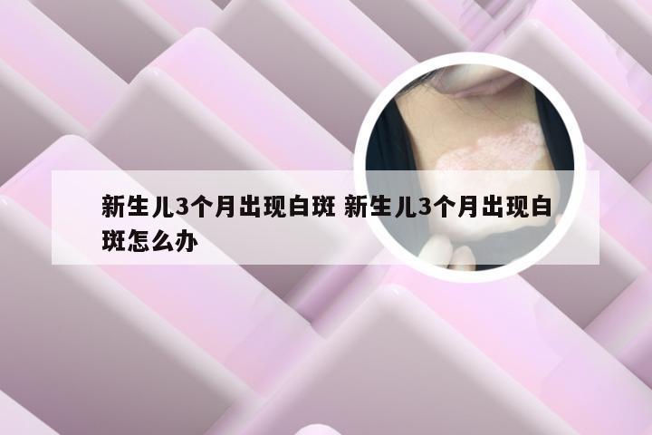 新生儿3个月出现白斑 新生儿3个月出现白斑怎么办