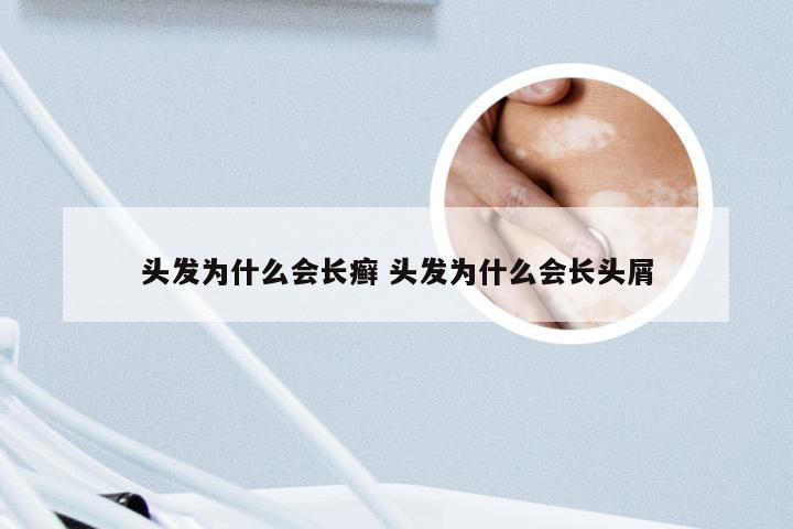 头发为什么会长癣 头发为什么会长头屑