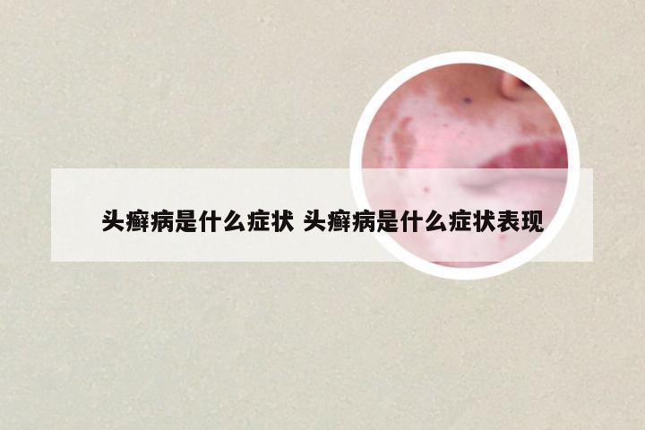 头癣病是什么症状 头癣病是什么症状表现