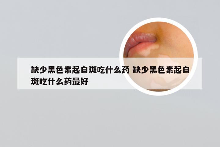 缺少黑色素起白斑吃什么药 缺少黑色素起白斑吃什么药最好