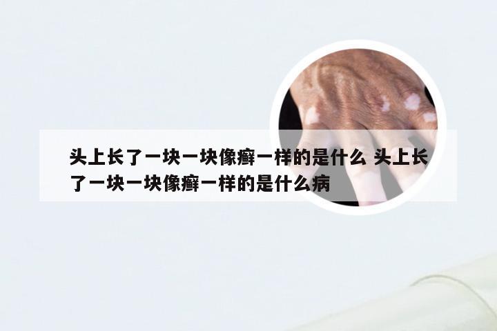 头上长了一块一块像癣一样的是什么 头上长了一块一块像癣一样的是什么病