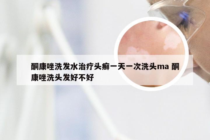 酮康唑洗发水治疗头癣一天一次洗头ma 酮康唑洗头发好不好