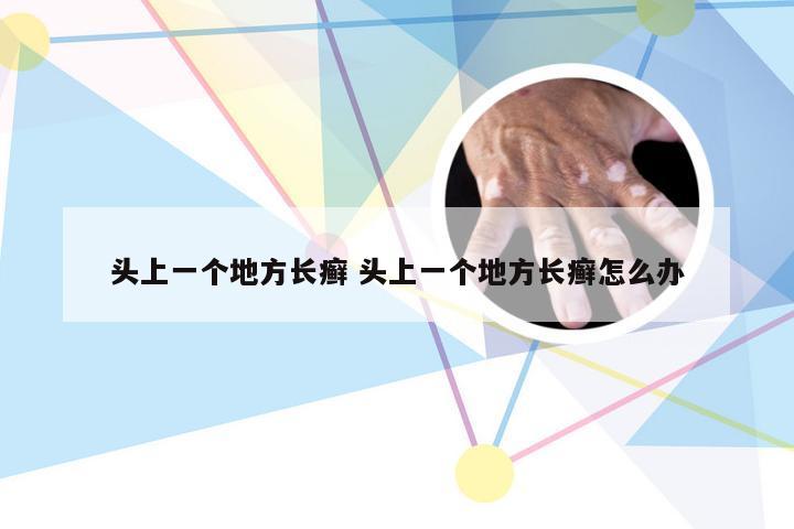 头上一个地方长癣 头上一个地方长癣怎么办