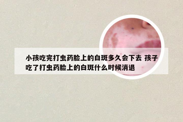 小孩吃完打虫药脸上的白斑多久会下去 孩子吃了打虫药脸上的白斑什么时候消退