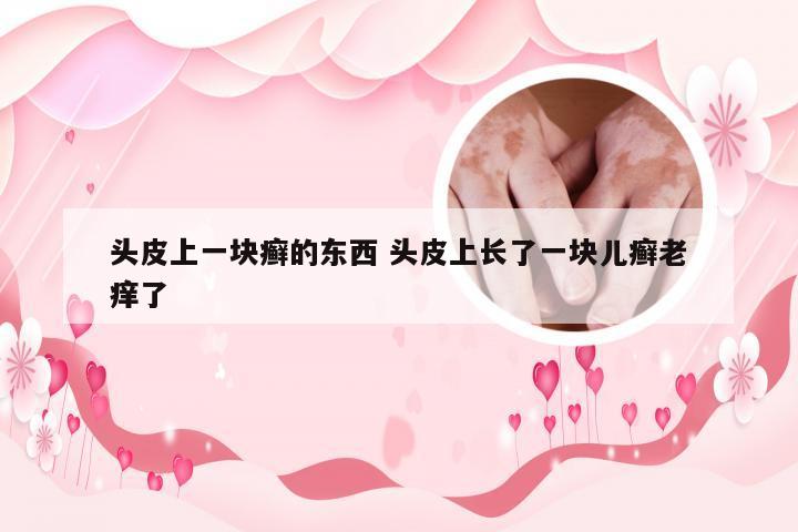 头皮上一块癣的东西 头皮上长了一块儿癣老痒了