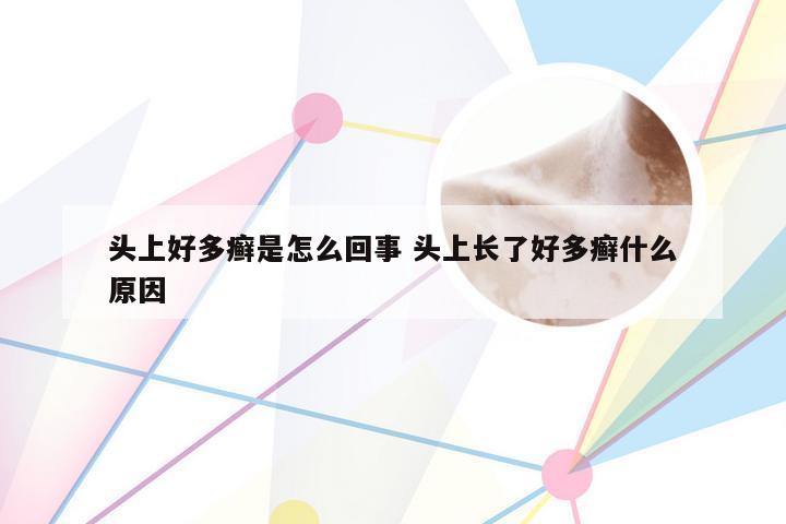 头上好多癣是怎么回事 头上长了好多癣什么原因