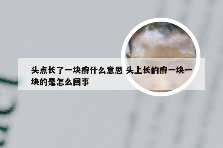 头点长了一块癣什么意思 头上长的癣一块一块的是怎么回事