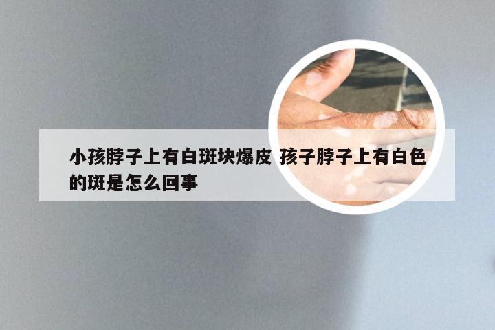 小孩脖子上有白斑块爆皮 孩子脖子上有白色的斑是怎么回事