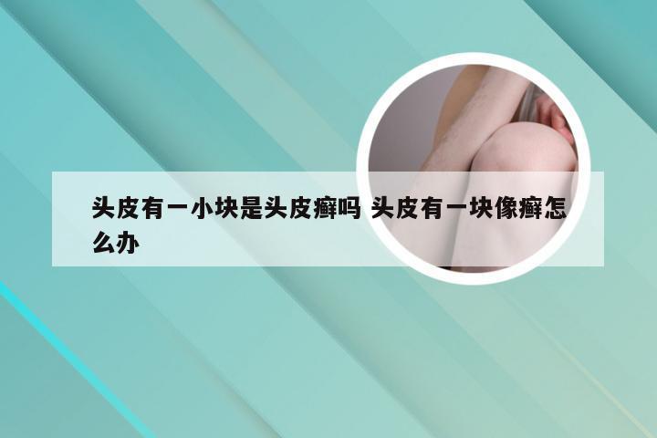 头皮有一小块是头皮癣吗 头皮有一块像癣怎么办