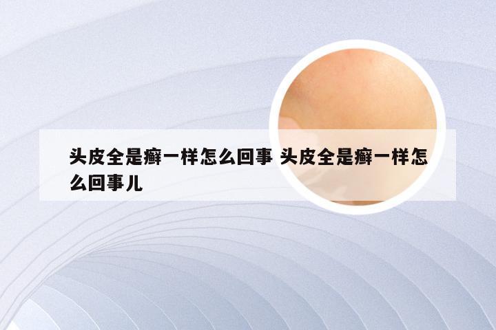 头皮全是癣一样怎么回事 头皮全是癣一样怎么回事儿