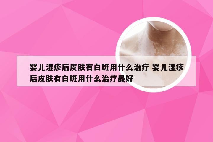 婴儿湿疹后皮肤有白斑用什么治疗 婴儿湿疹后皮肤有白斑用什么治疗最好