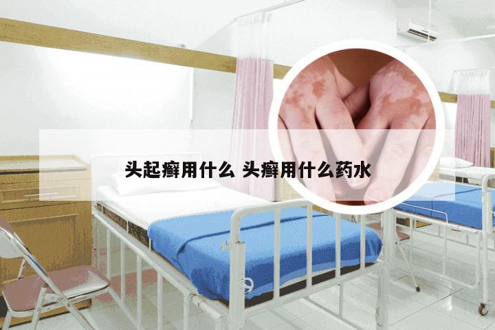 头起癣用什么 头癣用什么药水