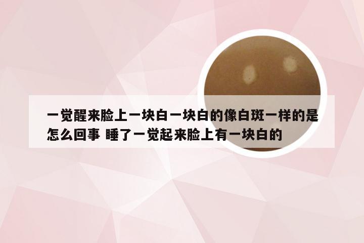 一觉醒来脸上一块白一块白的像白斑一样的是怎么回事 睡了一觉起来脸上有一块白的