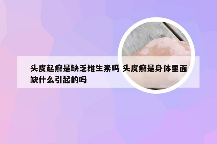 头皮起癣是缺乏维生素吗 头皮癣是身体里面缺什么引起的吗