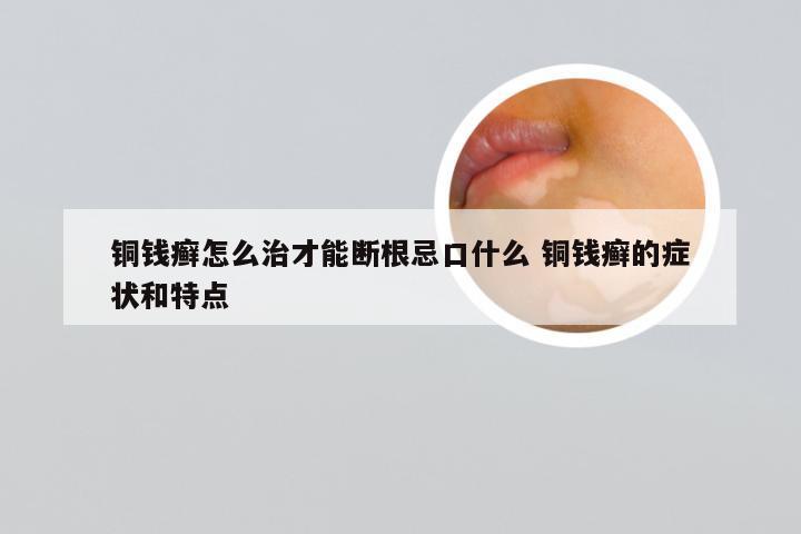 铜钱癣怎么治才能断根忌口什么 铜钱癣的症状和特点