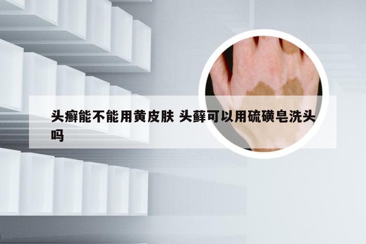 头癣能不能用黄皮肤 头藓可以用硫磺皂洗头吗