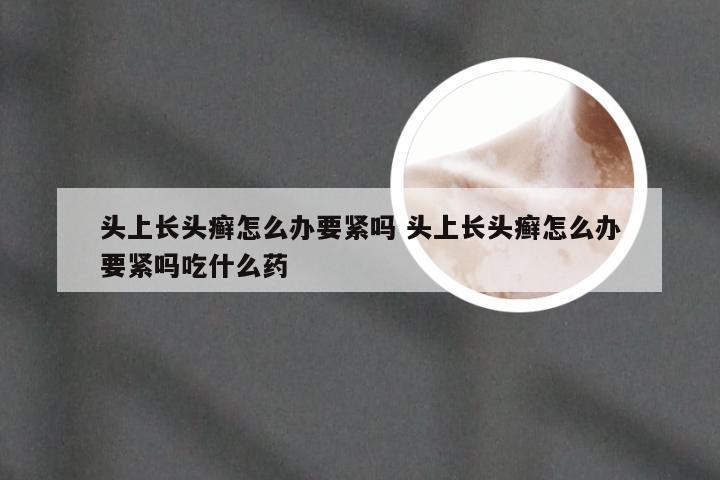 头上长头癣怎么办要紧吗 头上长头癣怎么办要紧吗吃什么药