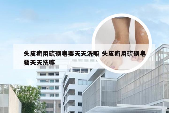 头皮癣用硫磺皂要天天洗嘛 头皮癣用硫磺皂要天天洗嘛