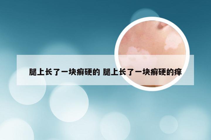 腿上长了一块癣硬的 腿上长了一块癣硬的痒