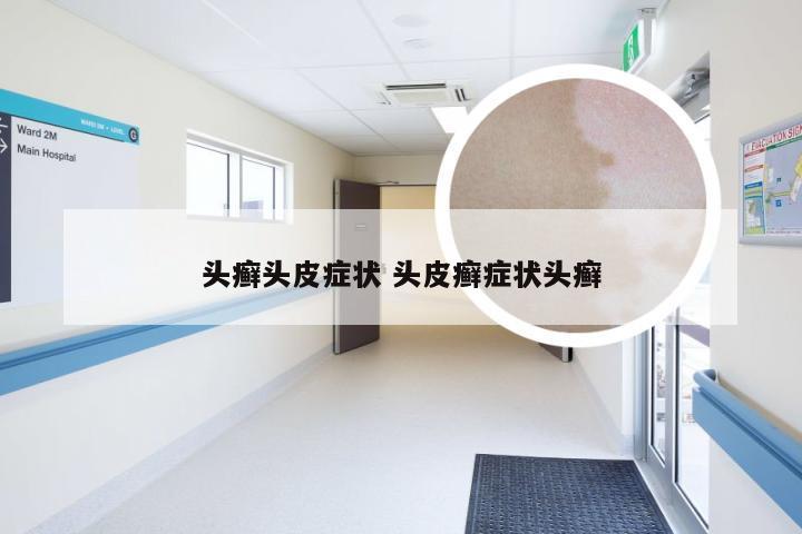 头癣头皮症状 头皮癣症状头癣