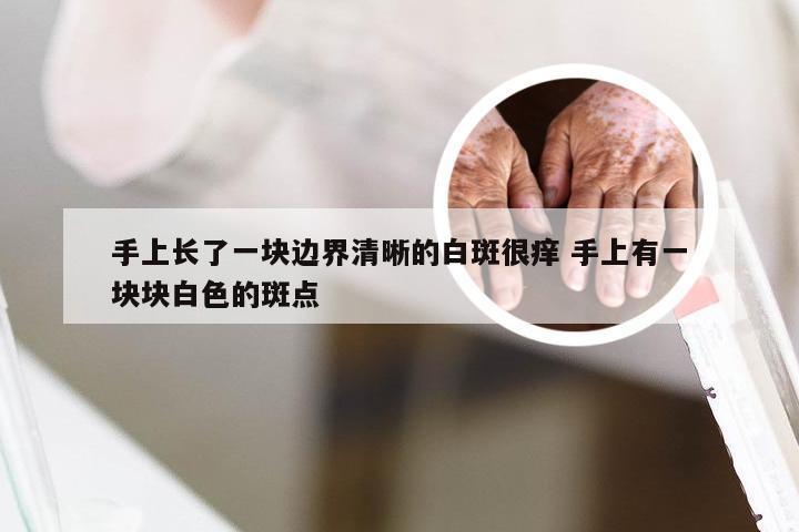 手上长了一块边界清晰的白斑很痒 手上有一块块白色的斑点