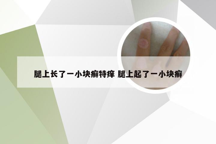 腿上长了一小块癣特痒 腿上起了一小块癣