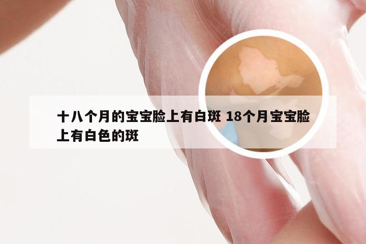 十八个月的宝宝脸上有白斑 18个月宝宝脸上有白色的斑