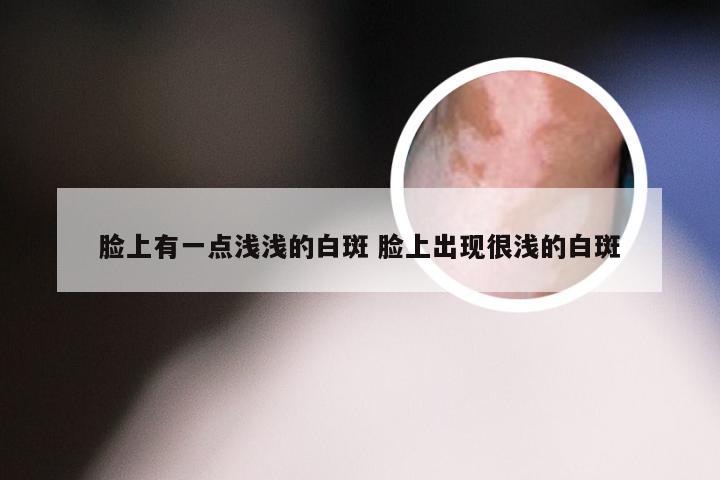 脸上有一点浅浅的白斑 脸上出现很浅的白斑