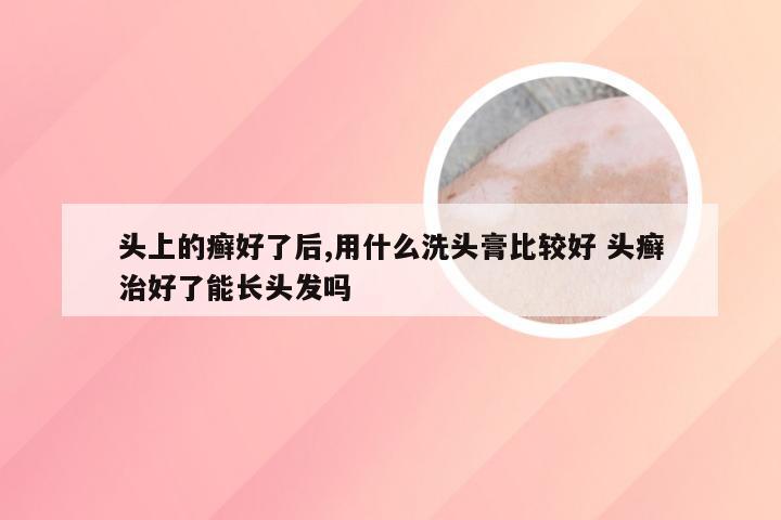 头上的癣好了后,用什么洗头膏比较好 头癣治好了能长头发吗