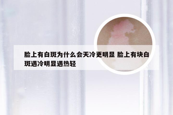 脸上有白斑为什么会天冷更明显 脸上有块白斑遇冷明显遇热轻
