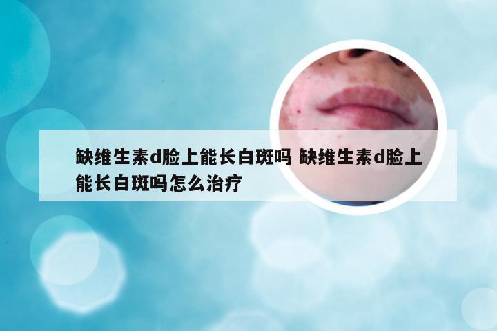 缺维生素d脸上能长白斑吗 缺维生素d脸上能长白斑吗怎么治疗