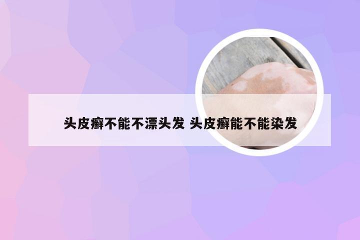 头皮癣不能不漂头发 头皮癣能不能染发