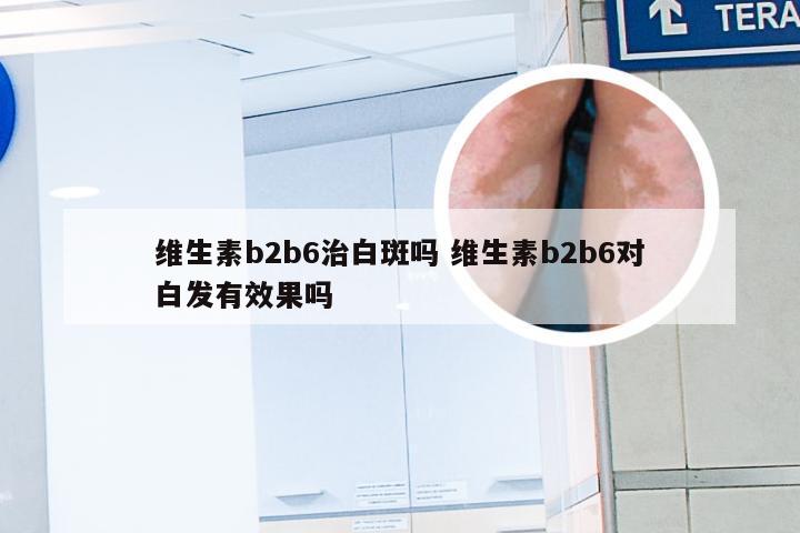 维生素b2b6治白斑吗 维生素b2b6对白发有效果吗