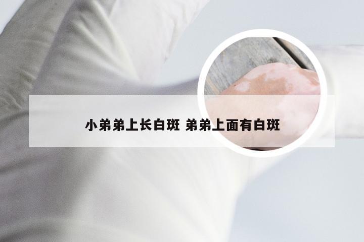 小弟弟上长白斑 弟弟上面有白斑
