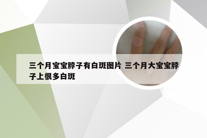 三个月宝宝脖子有白斑图片 三个月大宝宝脖子上很多白斑