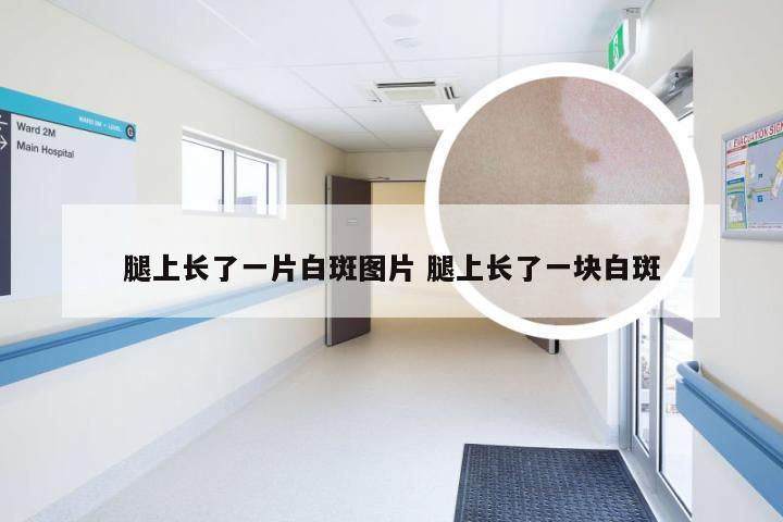腿上长了一片白斑图片 腿上长了一块白斑