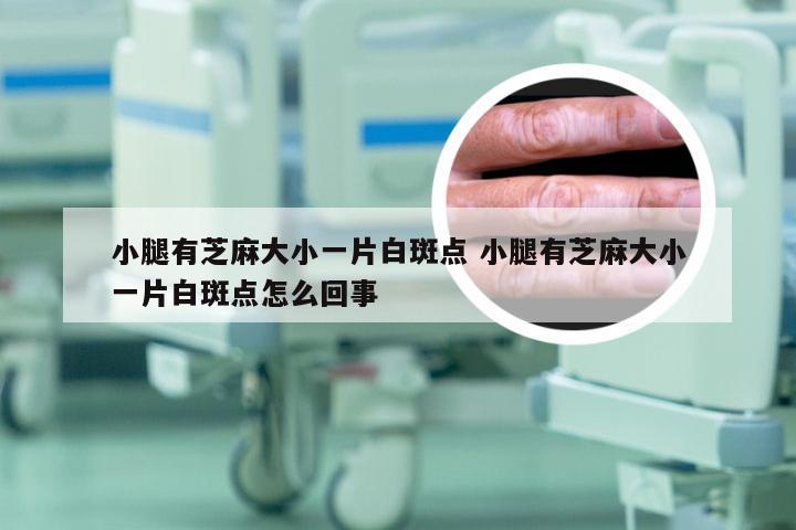 小腿有芝麻大小一片白斑点 小腿有芝麻大小一片白斑点怎么回事
