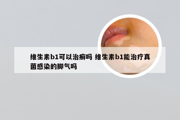 维生素b1可以治癣吗 维生素b1能治疗真菌感染的脚气吗